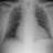 Logo Hudson Valley Radiologists, P C
